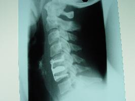 ΣΑΒΒΙΔΗΣ ΑΓΓΕΛΟΣ